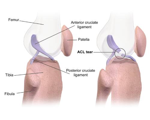 Shoulder Arthroscopy by Dr. Aditya Pawaskar, Specialist in Arthroscopy and Sports Injuries in Mumbai, Maharshtra in Matunga and Tardeo Road.