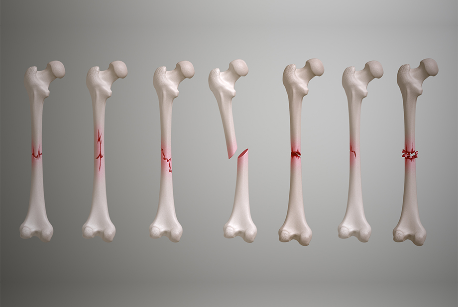 Shoulder Arthroscopy by Dr. Aditya Pawaskar, Specialist in Arthroscopy and Sports Injuries in Mumbai, Maharshtra in Matunga and Tardeo Road.