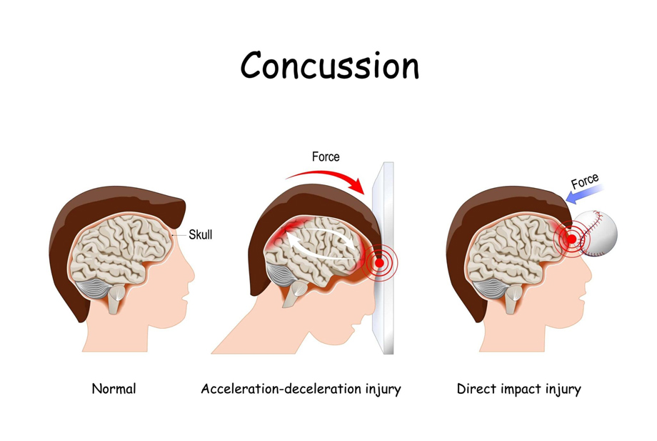 Shoulder Arthroscopy by Dr. Aditya Pawaskar, Specialist in Arthroscopy and Sports Injuries in Mumbai, Maharshtra in Matunga and Tardeo Road.