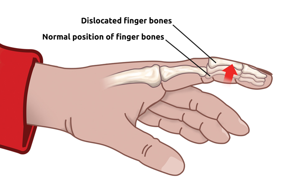 Shoulder Arthroscopy by Dr. Aditya Pawaskar, Specialist in Arthroscopy and Sports Injuries in Mumbai, Maharshtra in Matunga and Tardeo Road.