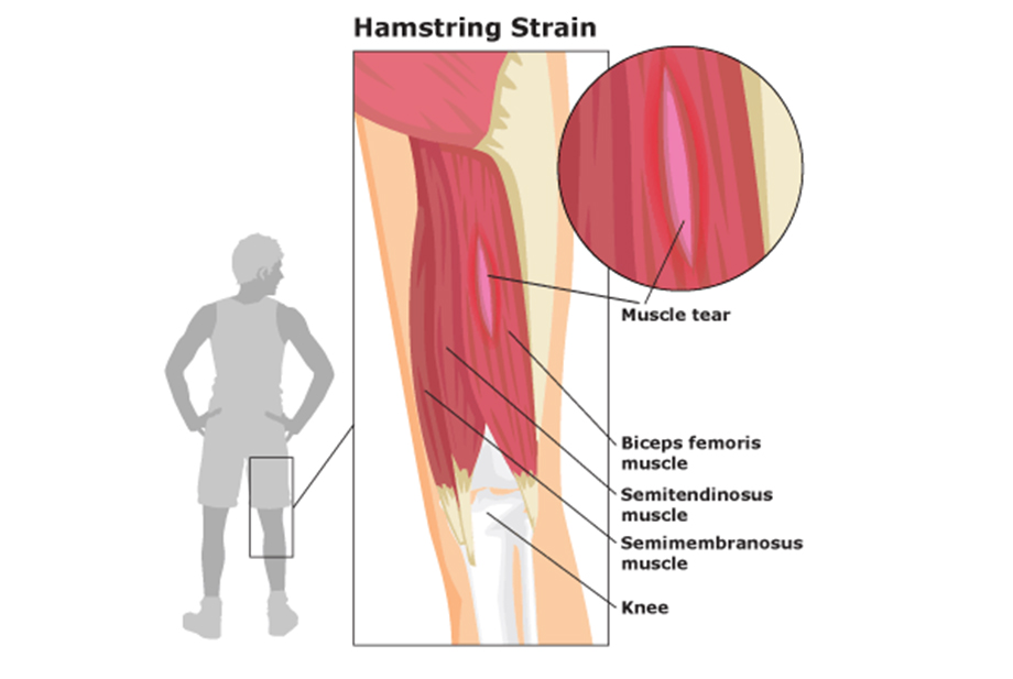 Shoulder Arthroscopy by Dr. Aditya Pawaskar, Specialist in Arthroscopy and Sports Injuries in Mumbai, Maharshtra in Matunga and Tardeo Road.
