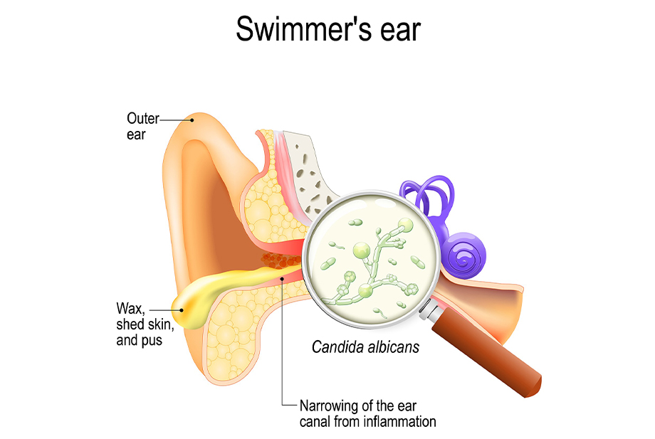 Shoulder Arthroscopy by Dr. Aditya Pawaskar, Specialist in Arthroscopy and Sports Injuries in Mumbai, Maharshtra in Matunga and Tardeo Road.