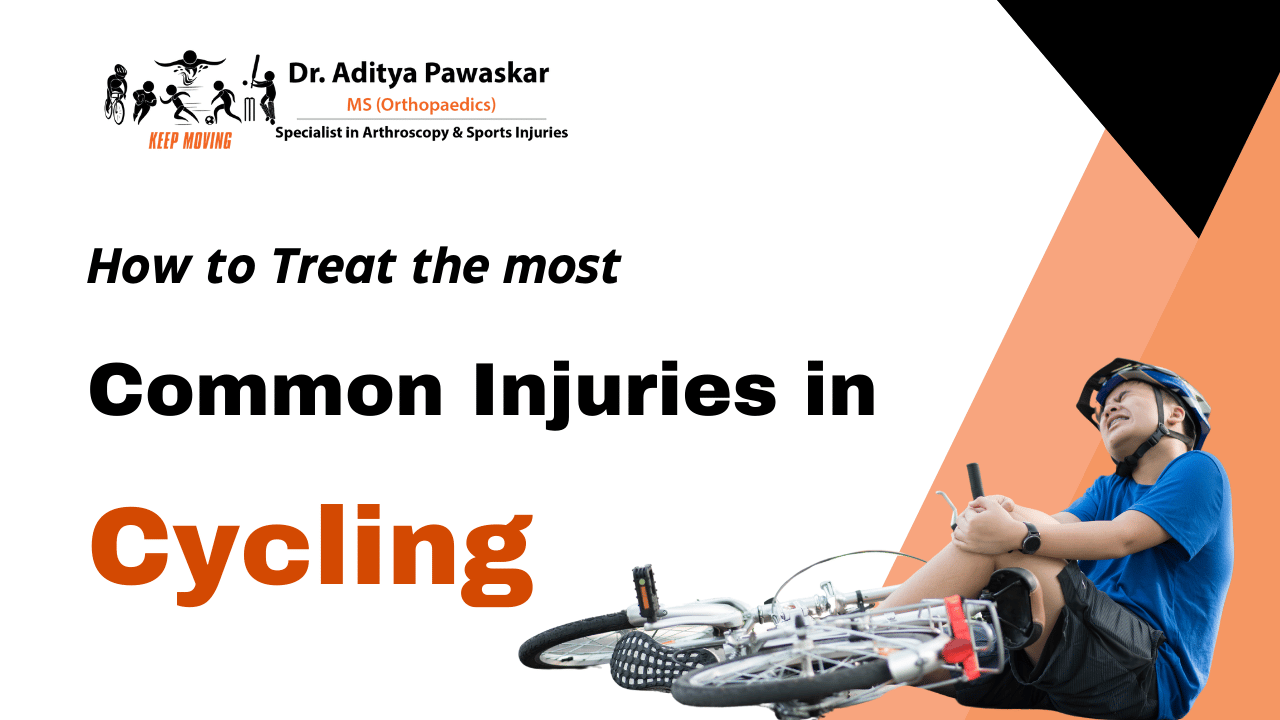 How to Treat the Most Common Injuries in Cycling