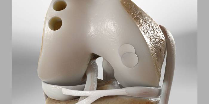 Articular Cartilage Repair by Dr. Aditya Pawaskar, Specialist in Arthroscopy and Sports Injuries in Mumbai, Maharshtra in Matunga and Tardeo Road.