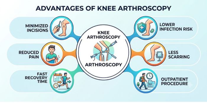 Benefits of knee arthroscopy treatment explained by the top 10 Sports Injury Specialist in Mumbai
