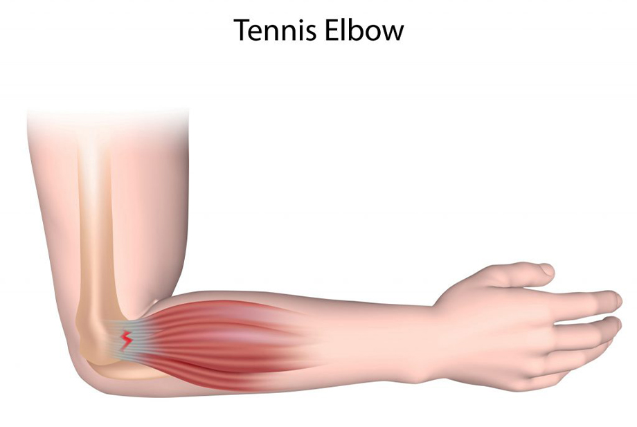 Shoulder Arthroscopy by Dr. Aditya Pawaskar, Specialist in Arthroscopy and Sports Injuries in Mumbai, Maharshtra in Matunga and Tardeo Road.