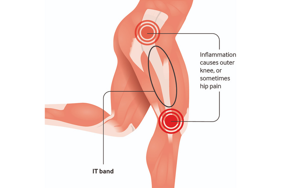 Shoulder Arthroscopy by Dr. Aditya Pawaskar, Specialist in Arthroscopy and Sports Injuries in Mumbai, Maharshtra in Matunga and Tardeo Road.